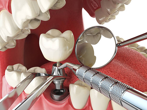 Best Walk-In Emergency Dentist in Owensville, MO